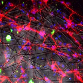 Neuronas activas, dentro de la red polímera.