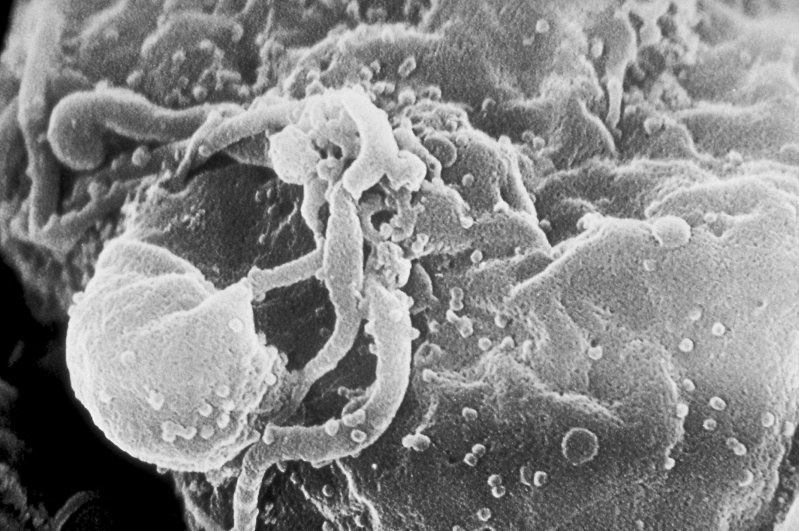 Imagen microscópica del virus del SIDA.