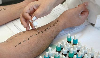 Test de alergia a diferentes sustancias.