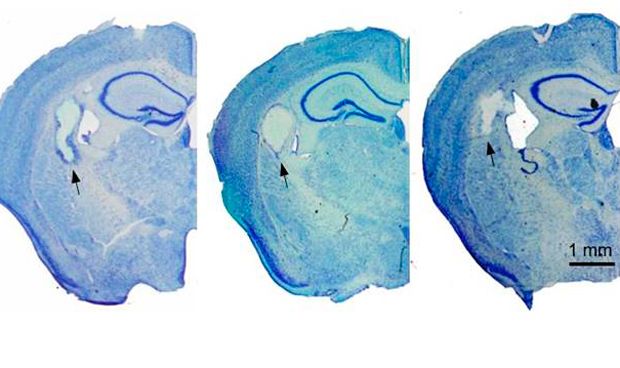 Hemisecciones cerebrales de animales trasplantados con hidrogel de fibroína de seda.